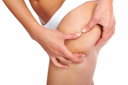 http://photos.happyherbivore.com/2013/08/stockfresh_2664368_woman-having-a-cellulite_sizeXS.jpg